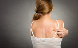 New and Alternative Strategies in Skin Irritation Testing